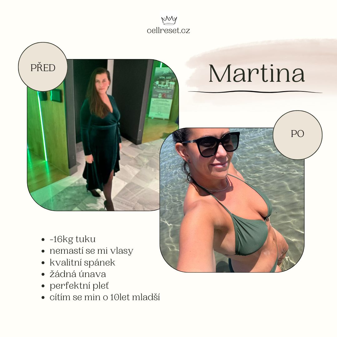 beige elegant minimalist beauty skincare before after instagram post (7)